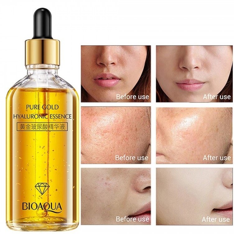 خرید و قیمت سرم پوست بایو آکوا مدل HYALURONIC ESSENCE حجم 100 میلی لیتر |  ترب