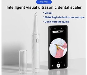 تصویر جرم گیر دندان هوشمند شیائومی Xiaomi Sunuo T12 Pro Ultrasonic Dental Scaler