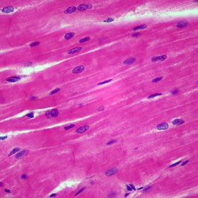 تصویر لام میکروسکوپی عضله قلبی (آموزشی) Microscopic slide of heart muscle