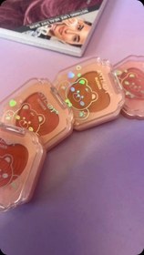 تصویر رژگونه آنالیدی - 04 