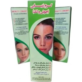 تصویر کرم زیبایی جوش و لک 