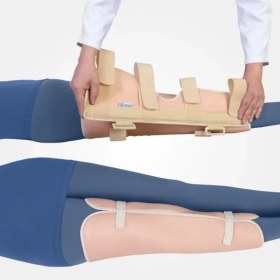 تصویر ثابت کننده زانو تک سایز Free Size Knee Immobilizer