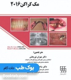 تصویر پروتز پارسیل متحرک مک کراکن 2016 