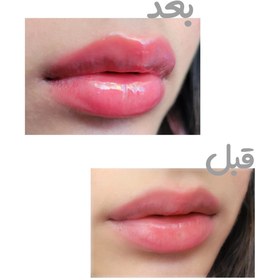 تصویر حجم دهنده لب آمپولی کلاژن TI&G.for ever LIP PLUMP MOIST & NOURISH COLLAGEN