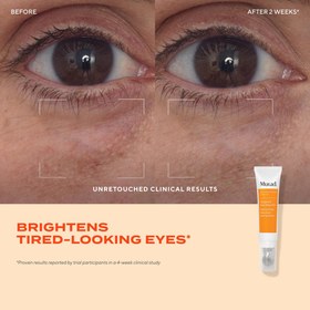 تصویر کرم دور چشم مورد مدل Targeted Eye Depuffer حجم ۱۵ میلی لیتر 
