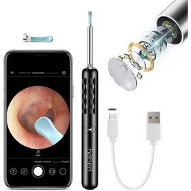 تصویر دستگاه آندوسکوپی و پاک کننده داخل گوش شیائومی Xiaomi Bebird R3 Smart Visual Ear Sticks Endoscope 