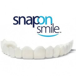 تصویر لمینت دندان دو فک مدل Snap on Smile عرضه شد برای فک بالا و پایین
