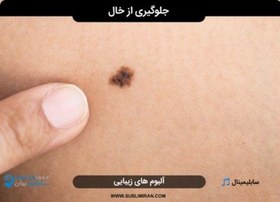 تصویر جلوگیری از خال زدن 