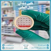 تصویر نگین دندان الماس 