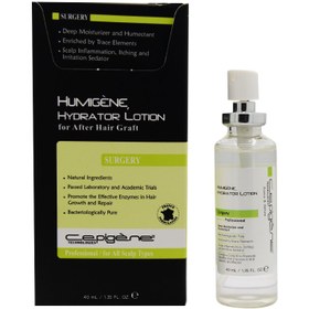 تصویر اسپری آبرسان بعد از کاشت موی سر Cepigene Cepigene Humigene Hydrator Lotion