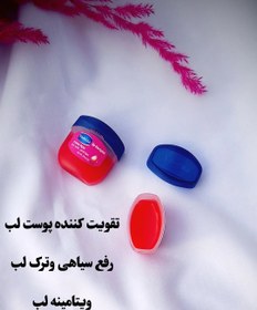 تصویر دیدی همچین که فصل سرما میرسه،لبامون شروع می‌کنه به پوسته 