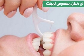 تصویر نخ دندان مخصوص لمینت آکوپ 