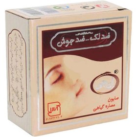 تصویر صابون ضد جوش ضد لک ان جی | مدل هربال NG Soap