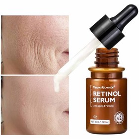 تصویر سرم ضد چروک ویبرانت گلمور مدل Retinol حجم 30 میلی لیتر 