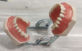 تصویر آرک ترمیمی لثه نرم همراه باآرتیکولاتور28عددی 