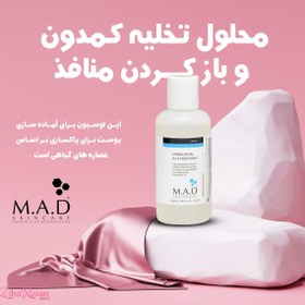 تصویر محلول تخلیه کمدون و بازکردن منافذ ام ای دی M.A.D 