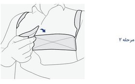 تصویر حمایت کننده قفسه سینه پس از جراحی پاک سمن 