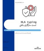 تصویر آزمایش HLA typing (تست سازگاری بافتی) 