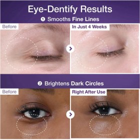 تصویر کرم دور چشم نامبوزین شماره ۹ حاوی NAD+ و رتینول حجم ۱۰ میل ضد چروک و روشن کننده 