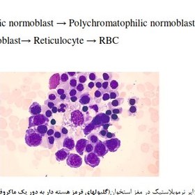 تصویر چرخه بلوغ و مرفولوژي هاي گوناگون گلبول قرمز و طريقه استاندارد گزارش آن 