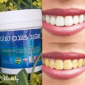 تصویر پودر سفید کننده دندان گیاهی 