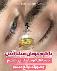 تصویر کرم تخصصی درمان میلیا دور چشمها و صورت 