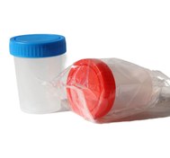 تصویر یورین باتل استریل درب دار 80ml (ظرف نمونه گیری ادرار) 