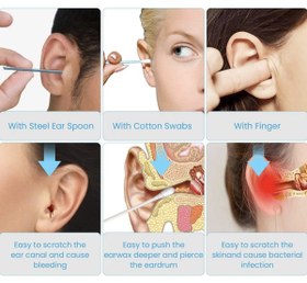 تصویر گوش پاک کن هوشمند شیائومی 