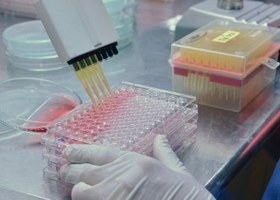 تصویر انجام تست MIC | تعیین حداقل غلظت مهار کنندگی | براث میکرودایلوشن Broth microdilution or MIC test