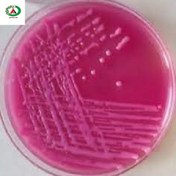 تصویر سوش باکتری کلبسیلا پنومونیه 