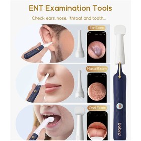 تصویر گوش پاک کن هوشمند بی برد شیائومی Bebird Earsight Plus I35R - 