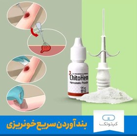 تصویر کیتوهم 