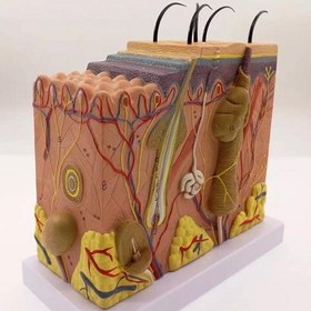 تصویر مولاژ پوست پلکانی 