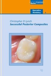 تصویر کتاب Successful Posterior Compostites : QuintEssentials of Dental Practice Vol. 32 دانلود pdf کتاب Successful Posterior Compostites : QuintEssentials of Dental Practice Vol. 32