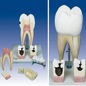 تصویر مدل (مولاژ) اولین دندان آسیاب فک تحتانی 