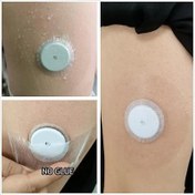 تصویر چسب سنسور فری استایل لیبره 2 بسته 5 عددی Freestyle Libre 2 sensor adhesive