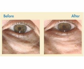 تصویر کرم دور چشم فیلورگا مدل اپتیم آیز Optim Eyes Eye Contour Cream