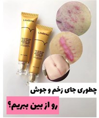 تصویر ژل کرم ترمیم کننده جای جوش و اسکار لانبنا LANBENA مدل SKIN CARE LANBENA