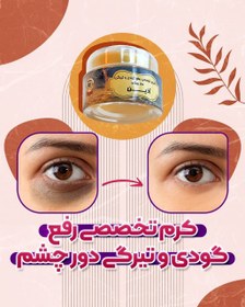 تصویر کرم تخصصی رفع گودی و تیرگی دور چشم آذین 