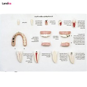 تصویر مدل مولاژ مراقب دندان های خود باشید 