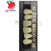 تصویر دندان مصنوعی 6 تایی قدامی بالا سوپر نیوکلار 