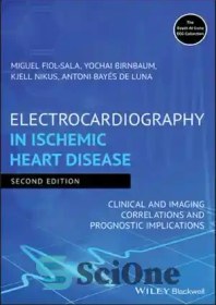 تصویر دانلود کتاب Electrocardiography in ischemic heart disease clinical and imaging correlations and prognostic implications - ارتباط بالینی و تصویربرداری و پیامدهای پیش آگهی الکتروکاردیوگرافی در بیماری ایسکمیک قلب 