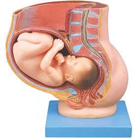 تصویر مولاژ حاملگی 