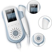 تصویر جنین یاب سونیکید مدل JPD-100E پرتابل 