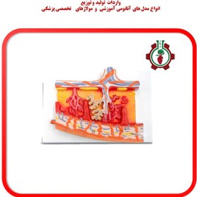 تصویر مولاژ جفت پاتولوژیک Pathological placenta moulage (14x18)