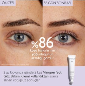 تصویر Caudalie کرم دور چشم Vinoperfect روشن کننده پوست دور چشم 15میل 