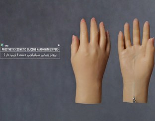 تصویر دست مصنوعی سیلیکونی (پروتز دست زیبایی) 