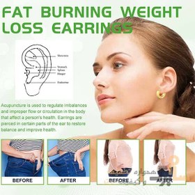 تصویر گوشواره کاهش اشتها وزن مدل Fat Burning ایلهو EELHOE 