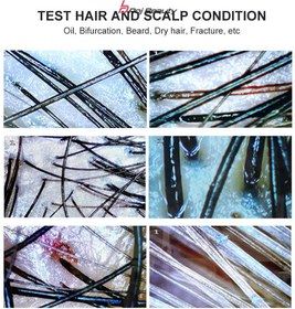 تصویر آنالیزور پوست و مو Best Klin مدل BD-701 