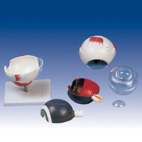 تصویر مولاژ کره چشم 